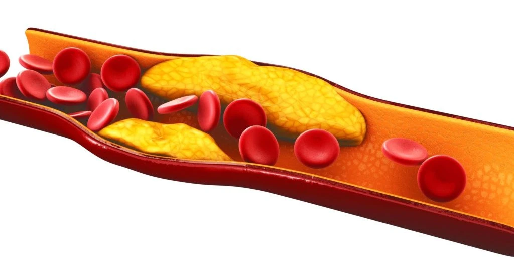 Холестерин.jpg Холестерин.jpg